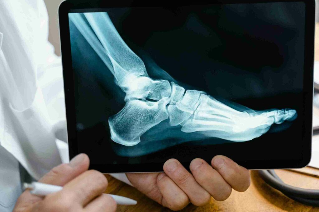 Doctor showing xray of foot