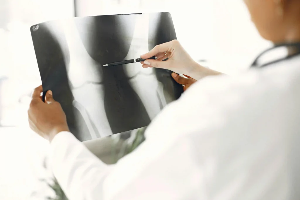 x-ray scan of bone injury