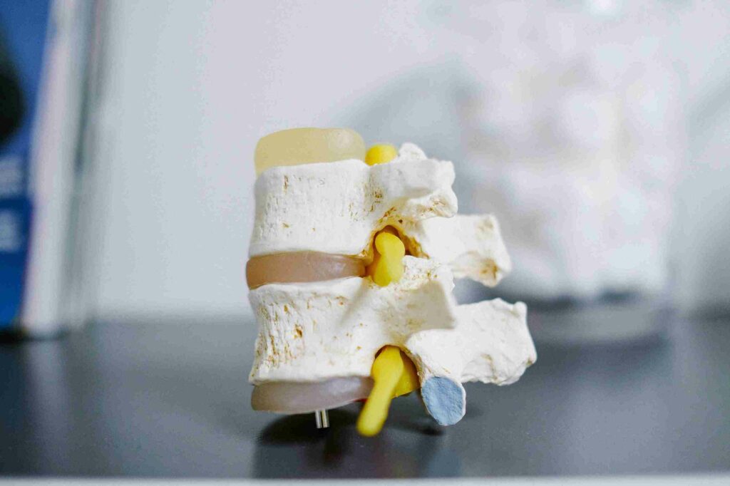 A model of two vertebrae