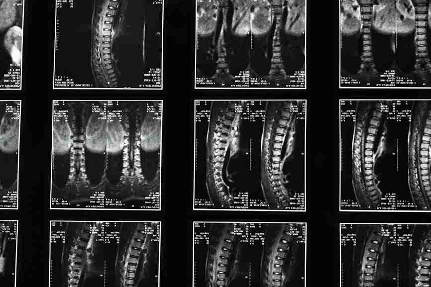 scans of spine