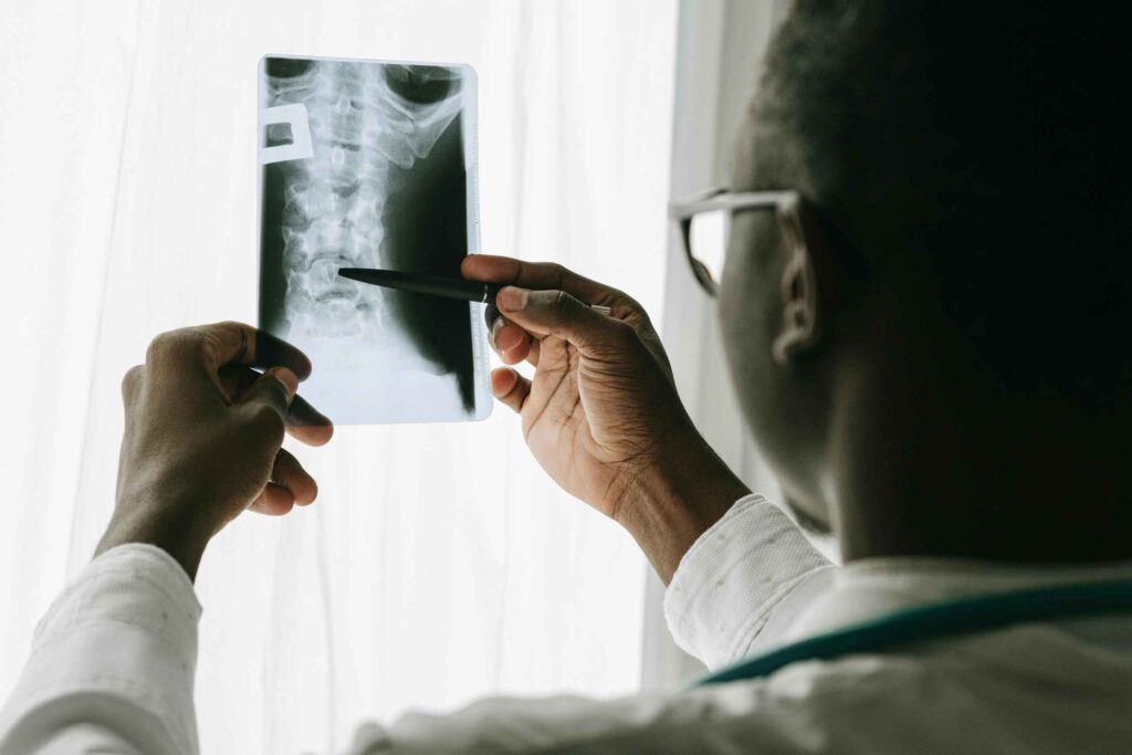 doctor examining an x-ray of spinal column