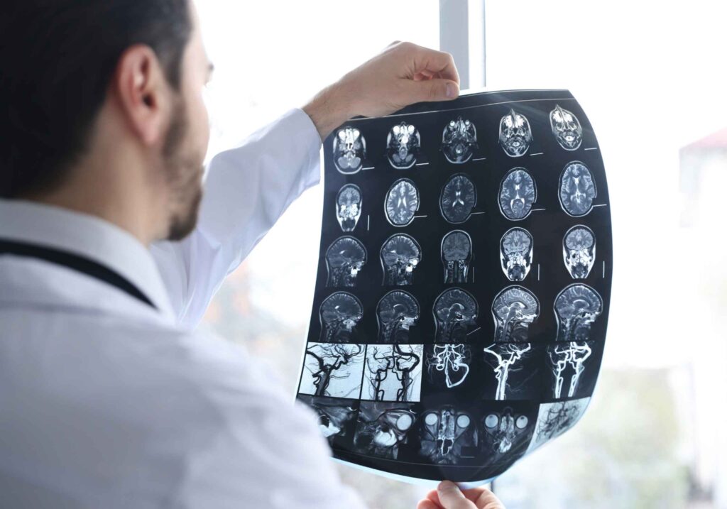 doctor studying brain scan