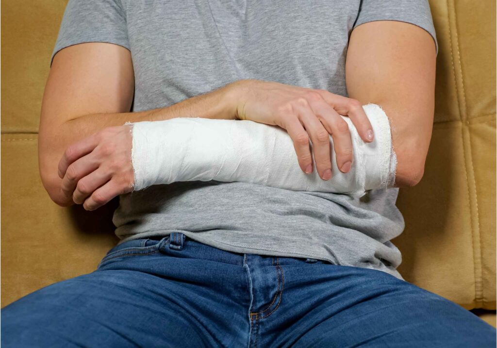 injured man with cast on arm
